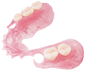 flexible partial denture