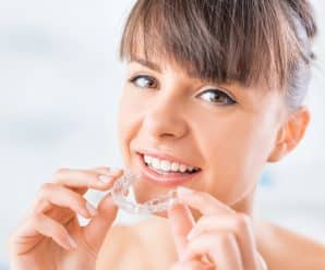 10 Benefits of Clear Aligners for Adults