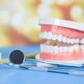 How Long Do Dentures Last on Average?