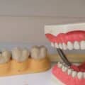 Everything You Need to Know About Mail Order Dentures